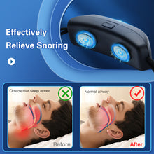 Afbeelding in Gallery-weergave laden, Smart Anti Snore Device